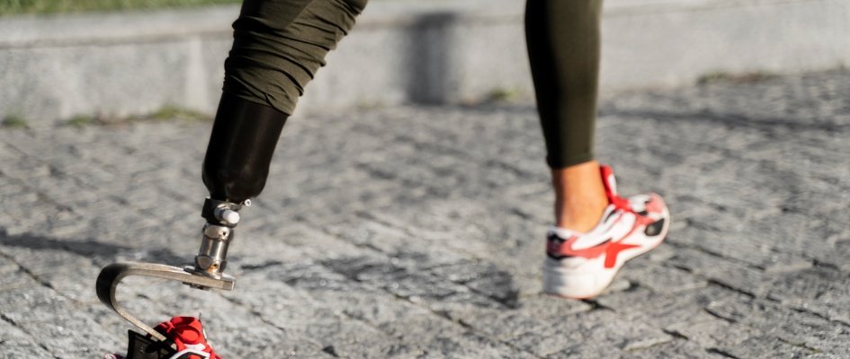 Extremidades diferentes